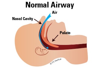 normal airway