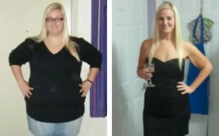 Before and After Image: Weight Loss - front